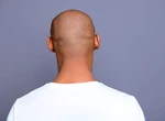 Cum să ai grijă de un scalp ras: rutina potrivită pentru bărbați