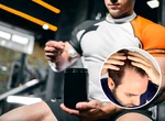 Legătura dintre creatină și pierderea părului: ce ne spun studiile