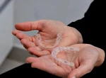 Ce este aparatul dentar invizibil și de ce tot mai mulți oameni îl folosesc. Tot ce trebuie să știi înainte să îl alegi
