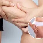 Patru pași simpli pentru a diminua celulita și tratamente care pot ajuta