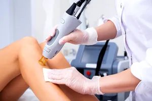 Ce trebuie să faci înainte și după epilarea definitivă cu laser. 7 sfaturi pentru cele mai bune rezultate