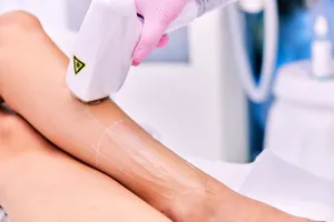 Ce trebuie să faci înainte de o ședință de epilare definitivă. Iată cum trebuie să te pregătești