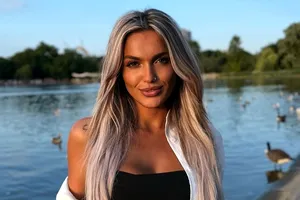 Ella Vișan, la un pas de moarte după o operație estetică făcută pentru iubitul ei: „Am dureri chiar și aici pe Insulă”