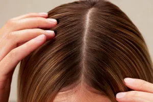 5 trucuri simple ca să scapi de mătreață și să ai un păr sănătos