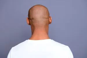 Cum să ai grijă de un scalp ras: rutina potrivită pentru bărbați