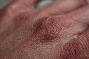 Cum scapi de mâini uscate și crăpate. Remediul natural cu care vei economisi banii, ai nevoie de câteva ingrediente banale