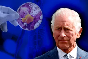 S-a aflat ce fel de cancer ar avea Regele Charles. Monarhului i s-ar mai fi dat doar doi ani de trăit, ce pregătiri se fac acum în Marea Britanie