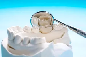 Obiceiurile alimentare care îți ruinează dantura. Ce mănânci zilnic și îți afectează smalțul dentar