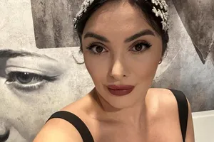 Ana Morodan, despre intervenția estetică făcută la nivelul nasului: “Sunt vânătă, însă nimeni nu m-a întrebat dacă sunt bine!” EXCLUSIV