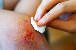 Când e suficient un plasture și când trebuie să mergi la doctor? Cum îngrijești corect o rană acasă
