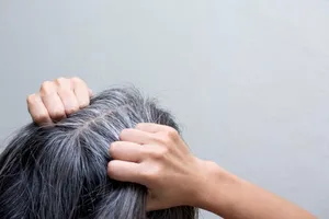 Spune adio firelor albe! Redă-ți culoarea naturală cu doar două ingrediente simple