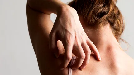 Cum recunoști dermatita. Semne și metode de prevenție