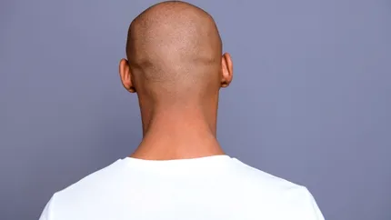Cum să ai grijă de un scalp ras: rutina potrivită pentru bărbați