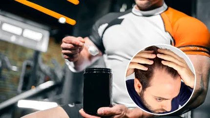 Legătura dintre creatină și pierderea părului: ce ne spun studiile