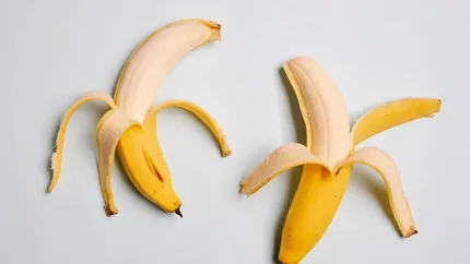 Ce poți face cu coaja de banană: 7 întrebuințări neașteptate pentru sănătate și frumusețe