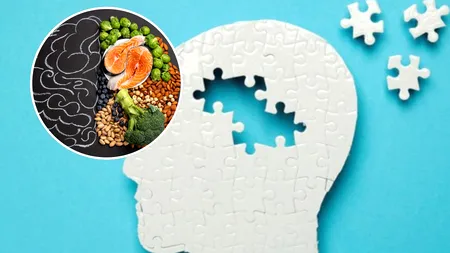 7 alimente recomandate de neurologi pentru reducerea riscului de demență