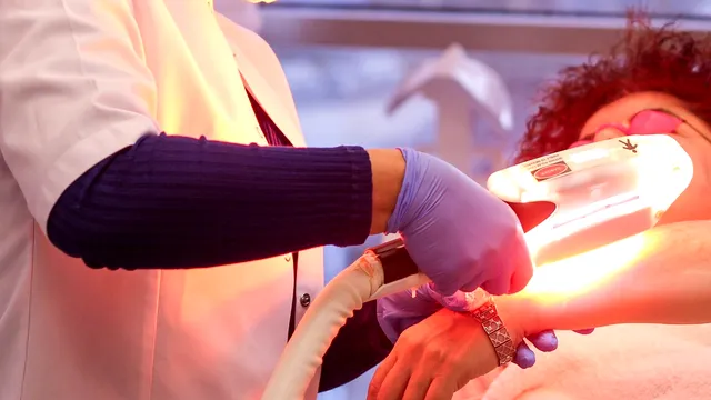 Ce beneficii are epilarea cu laser. Care sunt cele mai întâlnite greșeli după o ședință? Carmen Crăciun: „Pielea se irită” EXCLUSIV