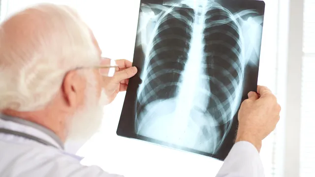 Boala care se răspândește agresiv în România. Medicii sunt în alertă după o explozie a numărului de cazuri