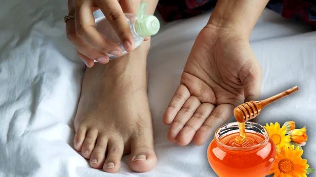 Cum scapi de călcâiele uscate și crăpate cu ingrediente naturale. 5 soluții care au rezultate rapide