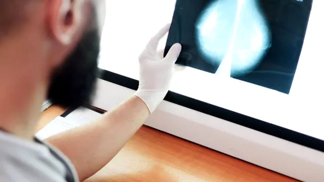 Care este diferența dintre mamografie și ecografie mamară. Ce trebuie să știe femeile despre aceste investigații