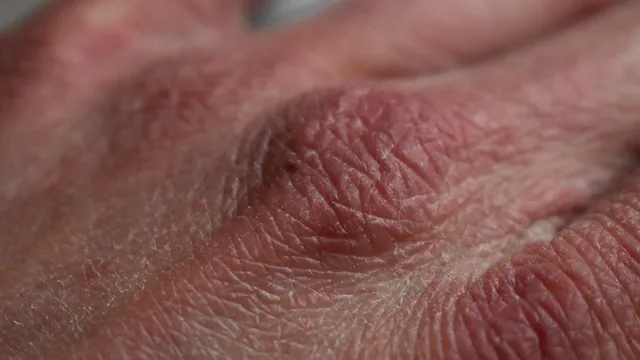 Cum scapi de mâini uscate și crăpate. Remediul natural cu care vei economisi banii, ai nevoie de câteva ingrediente banale