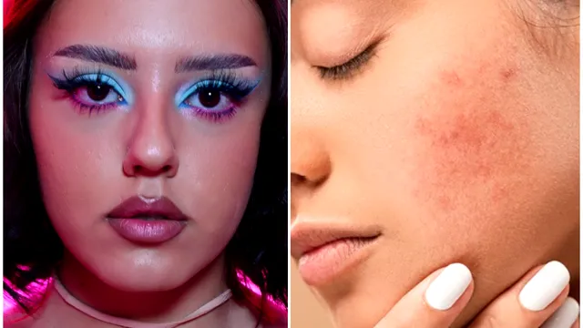 Machiajul tenului cu tendință acneică. Claudia Preduca, make-up artist: „Roșeața se ascunde cu un corector verde” SPECIAL