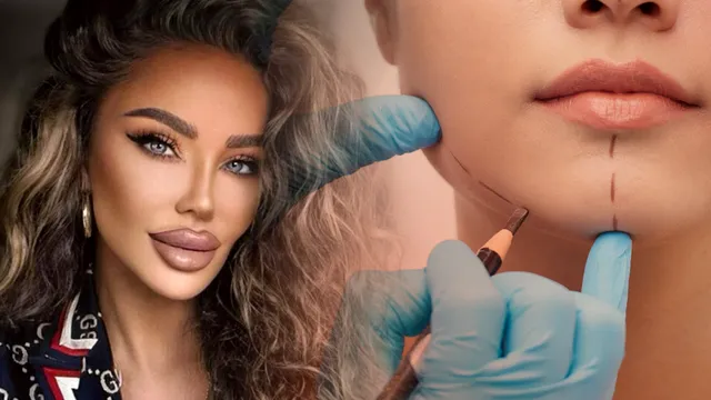 Cum arată Bianca Drăgușanu, după ce și-a făcut o nouă procedură estetică la față. Vedeta nu s-a sfiit să se afișeze așa în fața fanilor