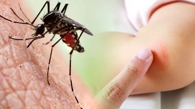 Planta care alungă țânțarii. Te protejează de înțepături, e aliatul ideal împotriva acestor insecte