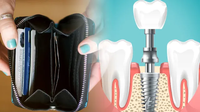 Cât costă un implant dentar în 2023. Prețurile sunt uriașe, suma pe care trebuie să o scoți din buzunar