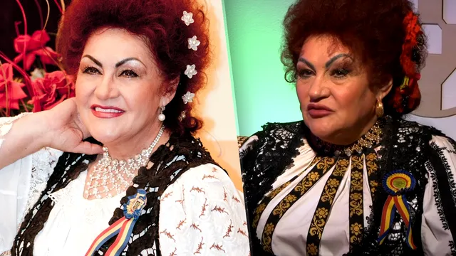 Câte operații estetice are Elena Merișoreanu, de fapt. Puține femei au curajul ei