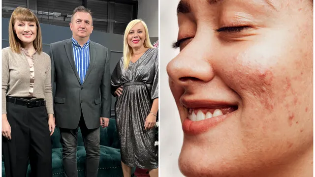 Ce este acneea și de ce apare? Dr. Irinel Nedelcu vorbește despre factorii care ne agresează zilnic tenul. Ce greșeli trebuie să evităm VIDEO EXCLUSIV