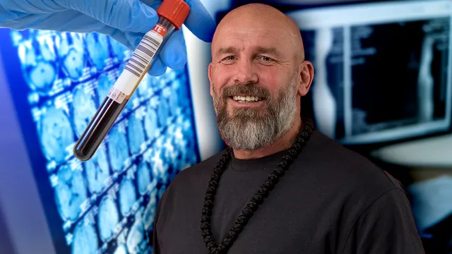 Boala cruntă de care este suspect Cătălin Zmărăndescu. Ce a descoperit în timpul controlului medical de la Survivor All Stars