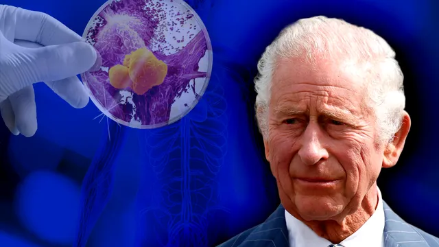 S-a aflat ce fel de cancer ar avea Regele Charles. Monarhului i s-ar mai fi dat doar doi ani de trăit, ce pregătiri se fac acum în Marea Britanie