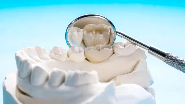 Obiceiurile alimentare care îți ruinează dantura. Ce mănânci zilnic și îți afectează smalțul dentar
