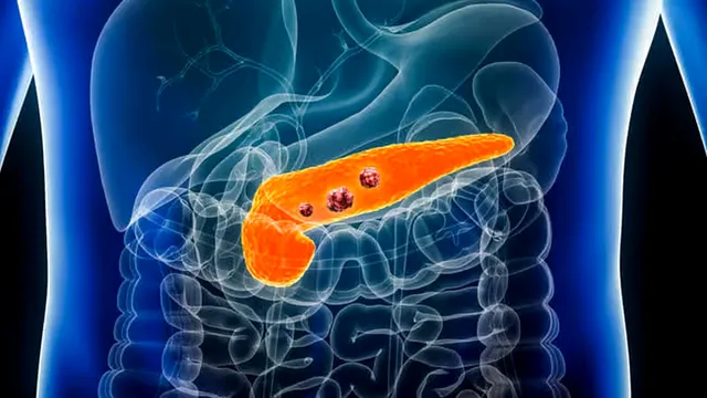 Secretul din spatele digestiei și echilibrului glicemic. Ce este pancreasul și ce rol are el?