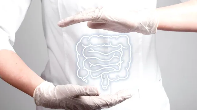 Cum să previi cancerul de colon. Sfaturi de la un specialist în microbiomul intestinal