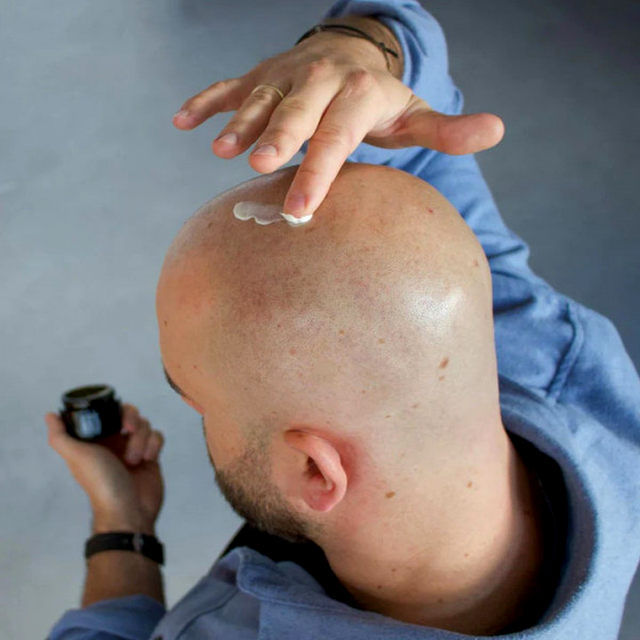 Aplicarea zilnică a unei creme hidratante previne uscăciunea și menține scalpul neted și sănătos