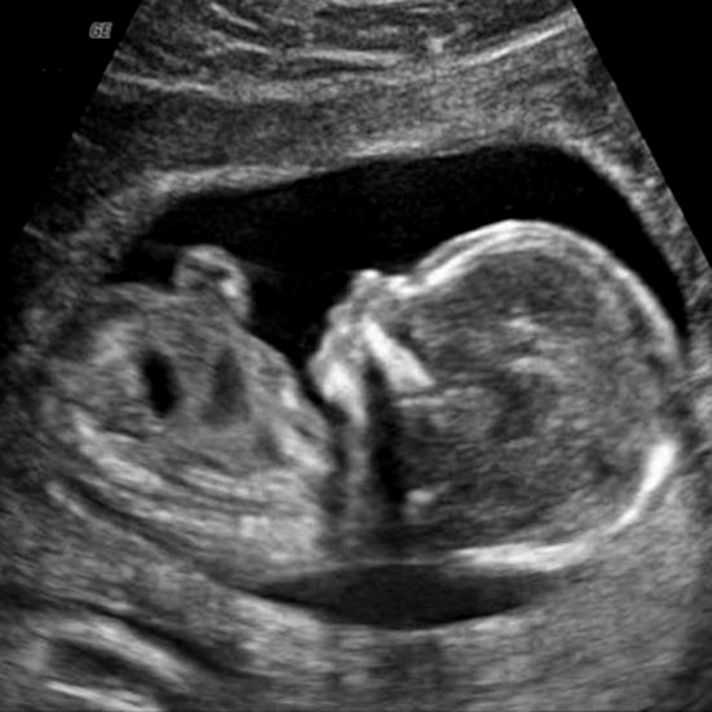 Analize în sarcină. Cele mai importante analize, explicate de medicul ginecolog. Orice viitoare mămică trebuie să știe asta