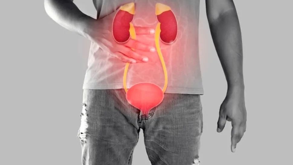Cum apar infecțiile urinare la bărbați? Tot ce trebuie să știi pentru a te proteja