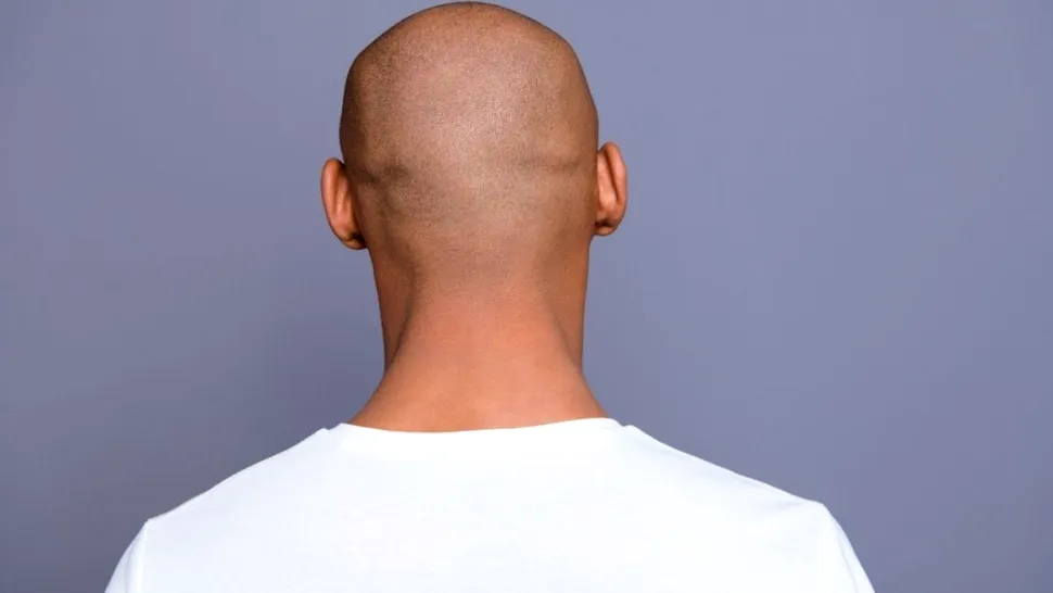 Cum să ai grijă de un scalp ras: rutina potrivită pentru bărbați