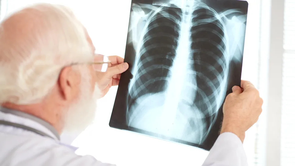 Boala care se răspândește agresiv în România. Medicii sunt în alertă după o explozie a numărului de cazuri