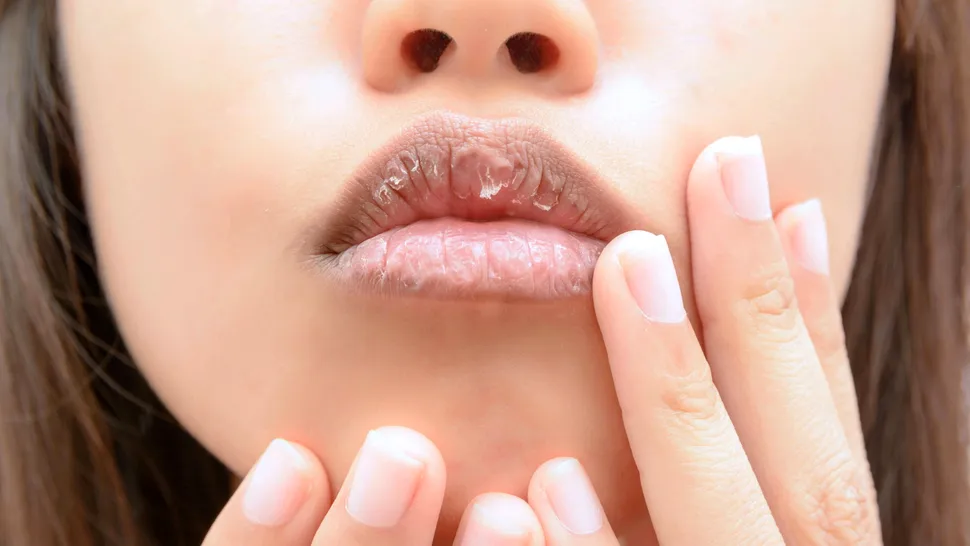 8 remedii naturale pentru buze uscate și crăpate. Ce poți să folosești pe post de balsam de buze