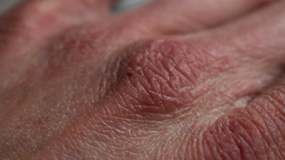 Cum scapi de mâini uscate și crăpate. Remediul natural cu care vei economisi banii, ai nevoie de câteva ingrediente banale