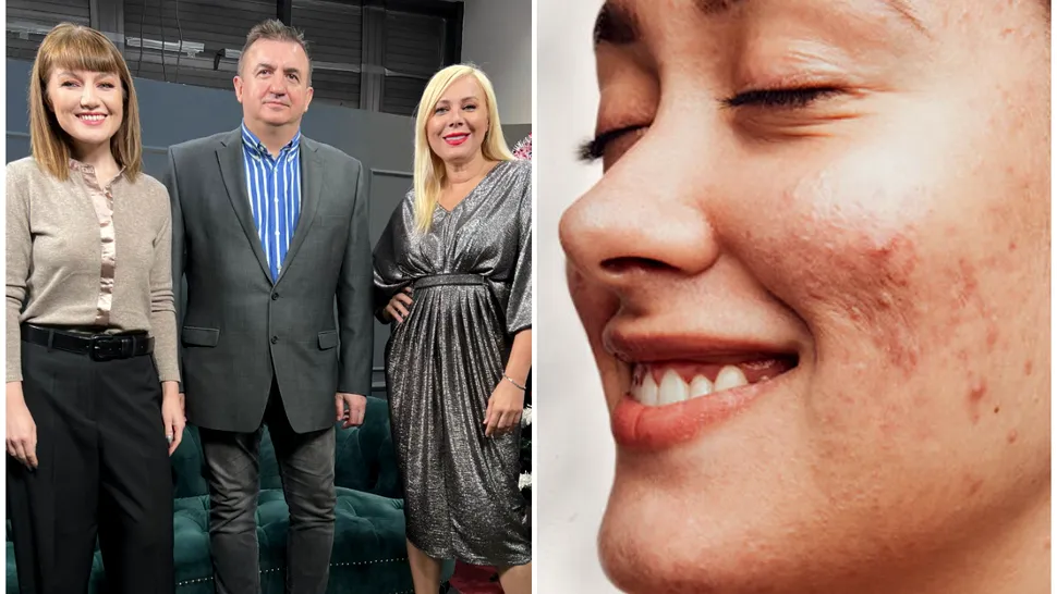 Ce este acneea și de ce apare? Dr. Irinel Nedelcu vorbește despre factorii care ne agresează zilnic tenul. Ce greșeli trebuie să evităm VIDEO EXCLUSIV