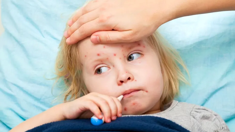 Adevărul despre rujeolă și vaccin. Medicii avertizează asupra complicațiilor grave