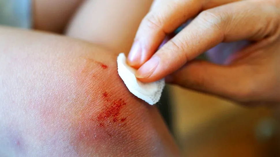 Când e suficient un plasture și când trebuie să mergi la doctor? Cum îngrijești corect o rană acasă